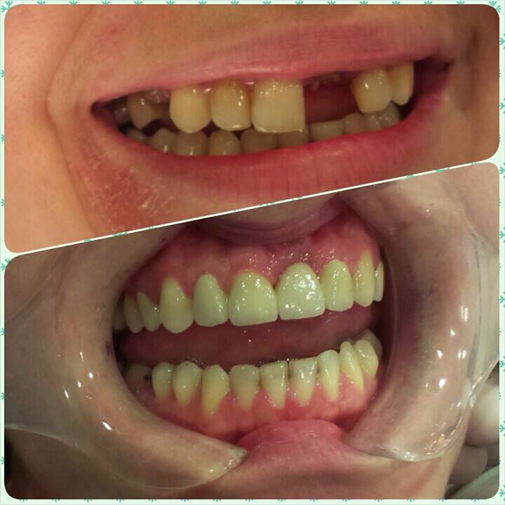 10985575_340249482842663_4402681529171364001_n