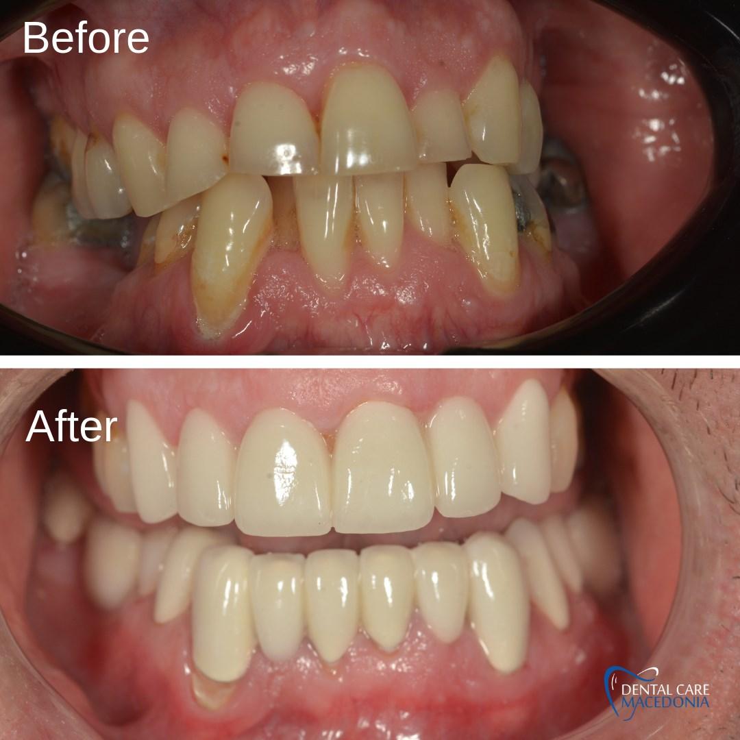 61423333_595270887625558_6876880117121941504_n